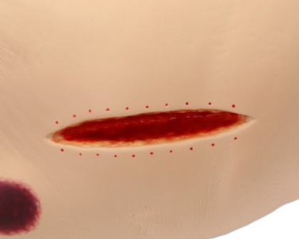 Dekubitus Pflegesimulator Seymour II