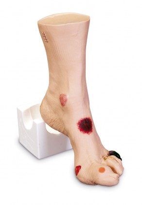 Wundset, Wundmoulage „Wilma“ Wundenfu�