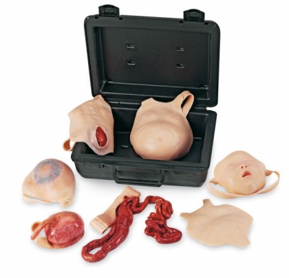"Neonatales Wundset"