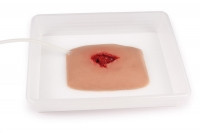 "Wundmoulage wound packing"