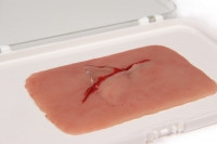 "Wundmoulage Schnittwunde mit Glassplitter"
