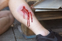 Wundmoulage Risswunde