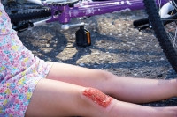 Wundmoulage Sch�rfwunde