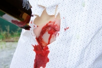 Wundmoulage Schnittwunde Flasche