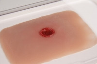 Wundmoulage Einschusswunde