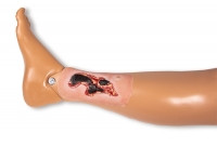 Wundmoulage Ulcus Cruris Arteriosum, klein, Exsudationsphase